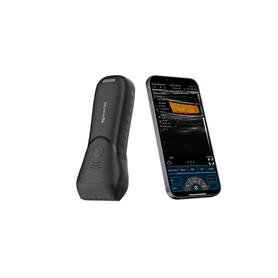 Lineer El Tipi Kablosuz Ultrason